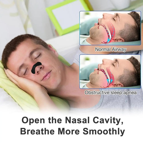 30/60/90/150 Nose Strips for Breathing Correction